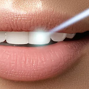 Kramer and Kramer Dental | Veneers, Implant Dentistry and Dentures